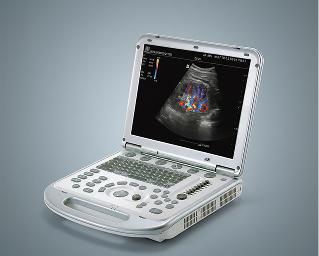 Ultrasound Machine