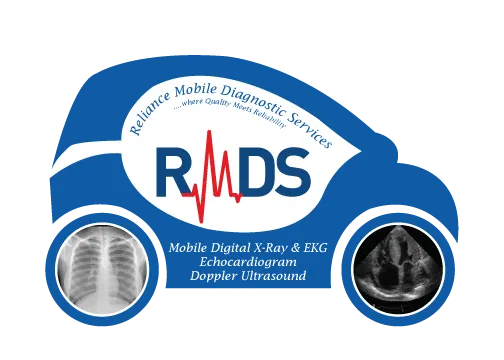 RMDS